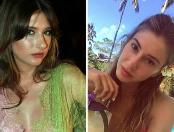 Şeyma Subaşı estetik operasyonlarına bir yenisini daha ekledi! Bu sefer de kalçasına... - Resim: 3