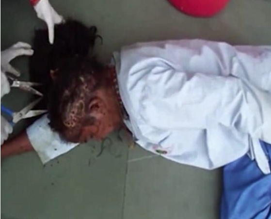 Tecavüz edildi yol kenarına atıldı kafasını kurtlar yerken... Skandal! - Resim: 4