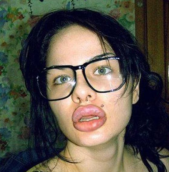 Onun yeni hali görenleri dehşete düşürüyor - Resim: 4