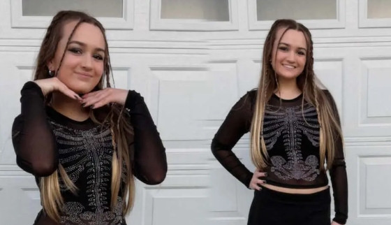 İnternetin efsane bakışlı kızı Chloe büyüdü, şimdiki halini görenler "yok artık" diyor - Resim: 7