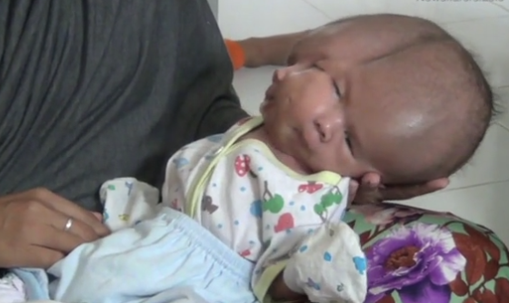 Dünya onları konuşuyor! İki yüzle doğdular  - Resim: 4