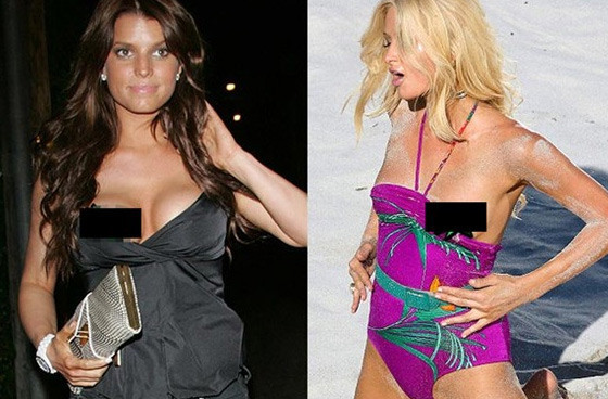 Ünlülerin utandıran kazaları - Resim: 1