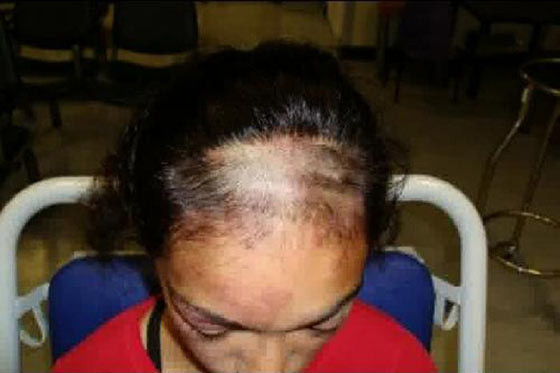 Türk kızını ne hale getirdiler! - Resim: 1