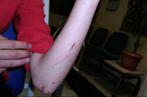 Türk kızını ne hale getirdiler! - Resim: 2