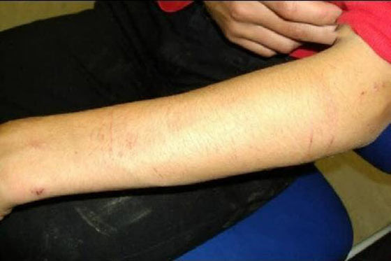 Türk kızını ne hale getirdiler! - Resim: 3