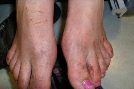 Türk kızını ne hale getirdiler! - Resim: 4