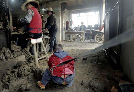 Aileleri onları zincirliyor! - Resim: 2