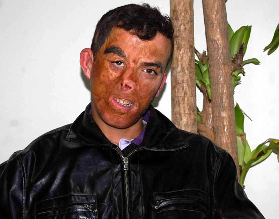 Türkiye'de bir ilk gerçekleşti - Resim: 2