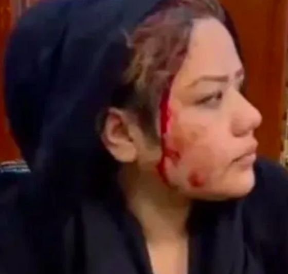 Afganistan'da dehşet fotoğraflar! Kadınlar kanlar içinde kaldı! DAEŞ militanı gözleri bağlı getirildi - Resim: 2