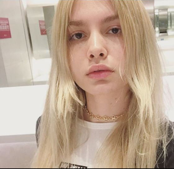 Aleyna Tilki dudaklarına dolgu mu yaptırdı işte yanıtı - Resim: 2