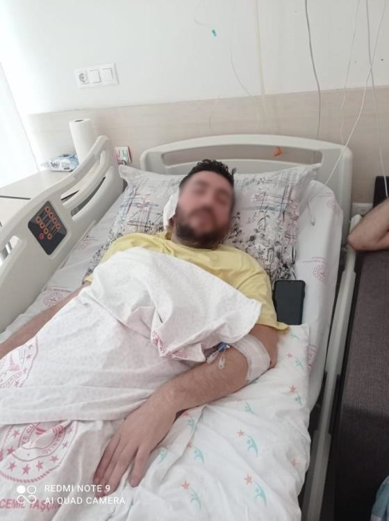 İstanbul’da baltalı oduncu dehşeti! Başına odunla vurulan genç felç kaldı - Resim: 2