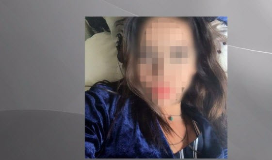 Göz rengi değiştirme ameliyatı az daha kör ediyordu - Resim: 2