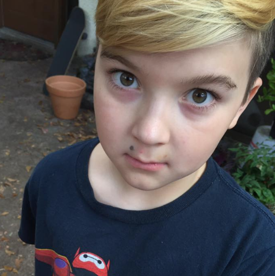 Bu fotoğrafı bilmeyen yok bir de çocuğun son haline bakın! - Resim: 4