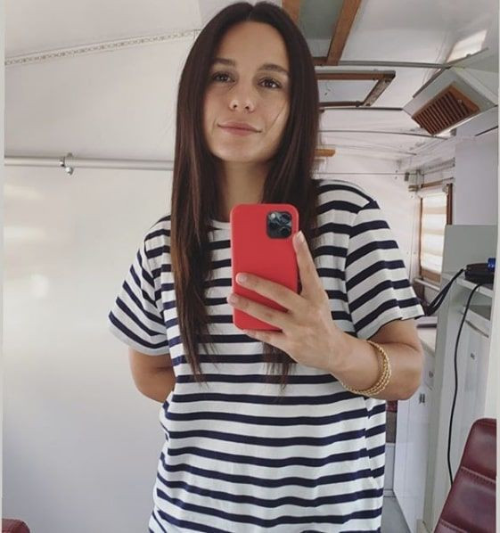 ATV dizisinde oynayan Selin Yeninci burun estetiği yaptırdı işte son hali - Resim: 2