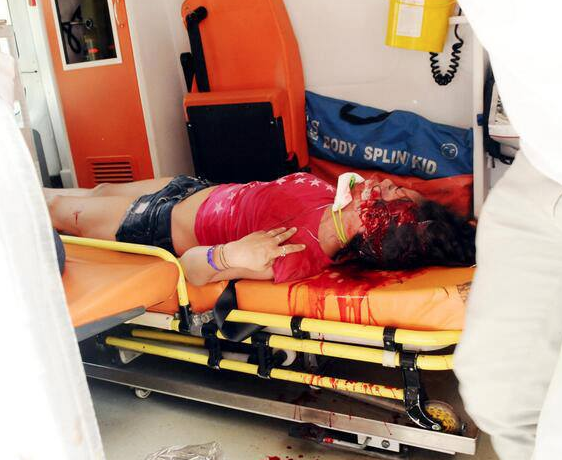 Taksim Gezi Parkı savaş alanı gibi... - Resim: 1