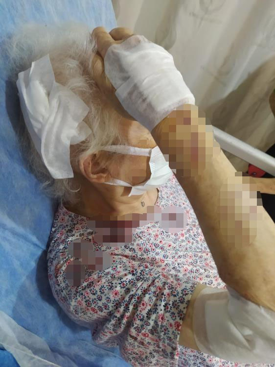 İstanbul'da başıboş maymun dehşeti: 3 kişiye saldırdı - Resim: 2