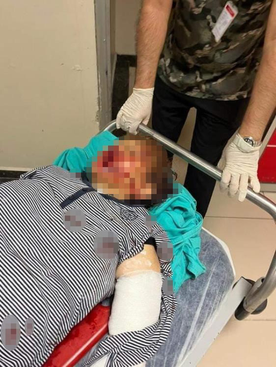 Torundan dede ve babaanneye öldüresiye dayak - Resim: 0