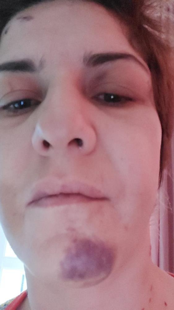 İzmir'de işkenceci dini nikahlı kocanın 'son bir kez sarılayım' oyunu - Resim: 3