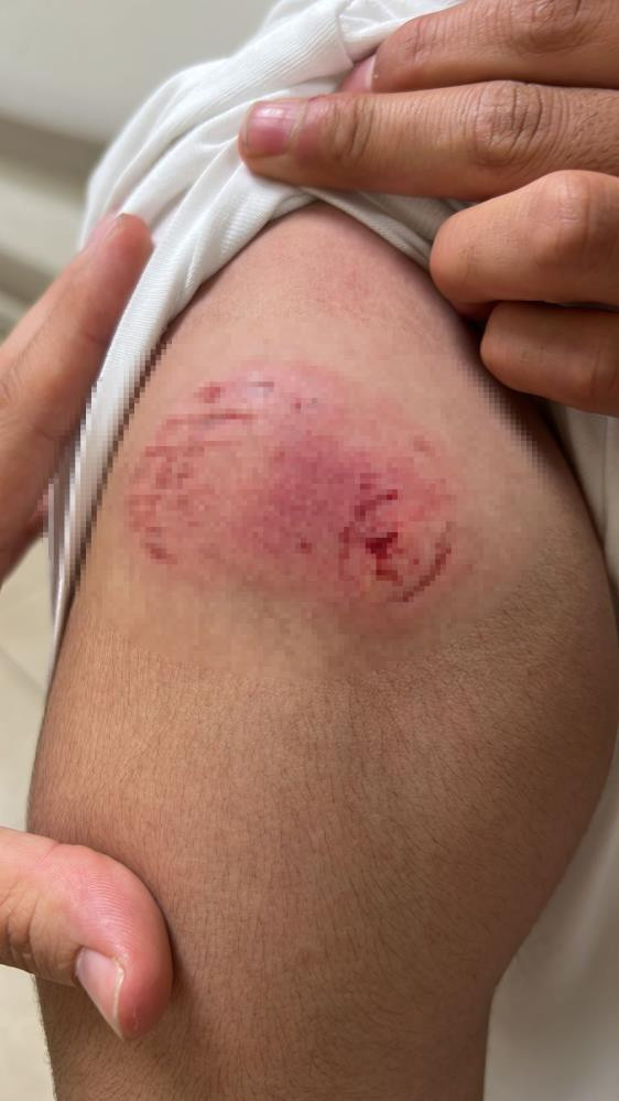 Alçılı kolla ve falçatayla saldırıp, kulağından ısırdı! Galata'da akılalmaz kavga - Resim: 5