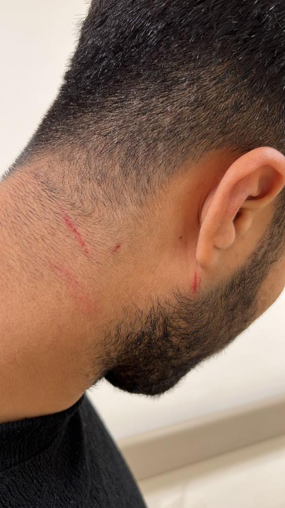 Alçılı kolla ve falçatayla saldırıp, kulağından ısırdı! Galata'da akılalmaz kavga - Resim: 4