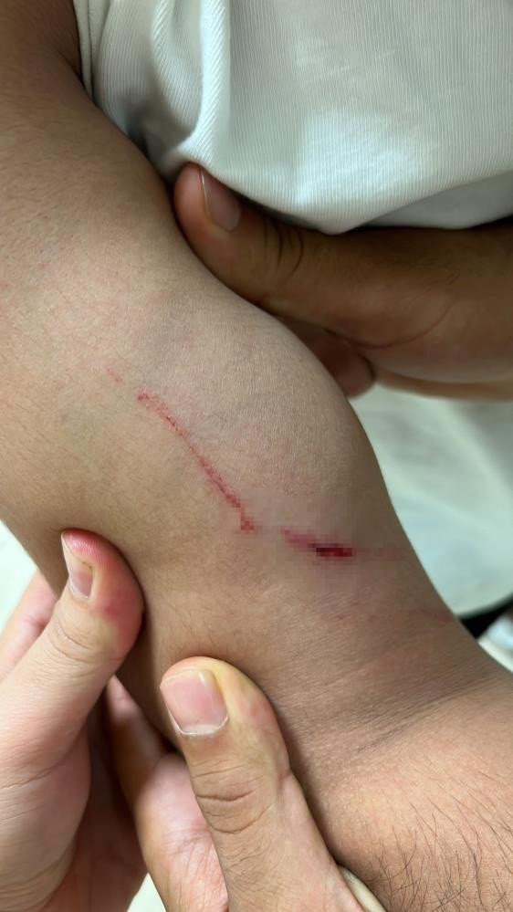 Alçılı kolla ve falçatayla saldırıp, kulağından ısırdı! Galata'da akılalmaz kavga - Resim: 2