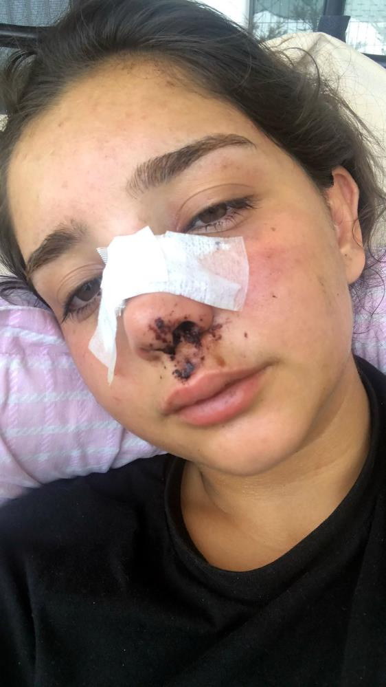 Genç kız yaşadığı dehşeti gözyaşları içinde anlattı: Bu insanlık değil... - Resim: 0