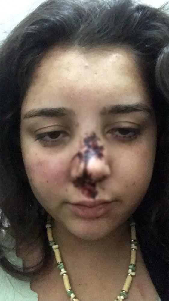 Genç kız yaşadığı dehşeti gözyaşları içinde anlattı: Bu insanlık değil... - Resim: 1