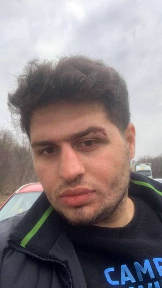 Rusya bombaladı Türk öğrenci Ukrayna'da yaralandı! Dehşeti yaşadı: Türk olduğumuzu söyleyince... - Resim: 4