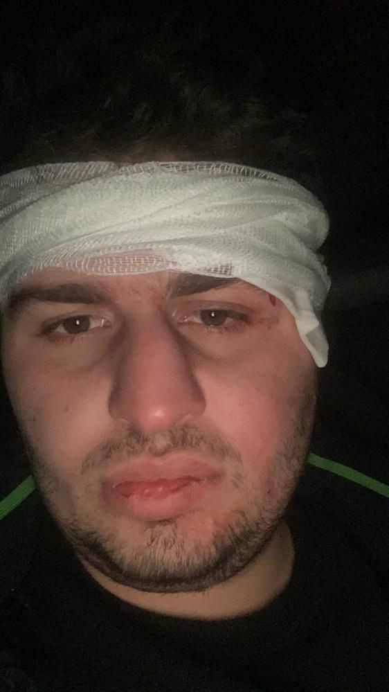 Rusya bombaladı Türk öğrenci Ukrayna'da yaralandı! Dehşeti yaşadı: Türk olduğumuzu söyleyince... - Resim: 3