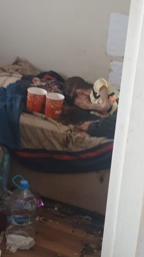 Bursa'da çöp evde bulunan Cem Muhammet'den haber var! İşte son sağlık durumu - Resim: 2