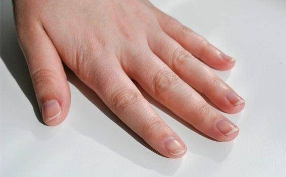 Tırnaklarınızda beyaz leke varsa dikkat! - Resim: 2