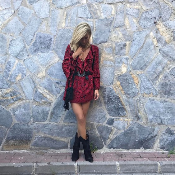 Çağla Şıkel'in estetiksiz haline bakın değişimi şoke edecek - Resim: 4