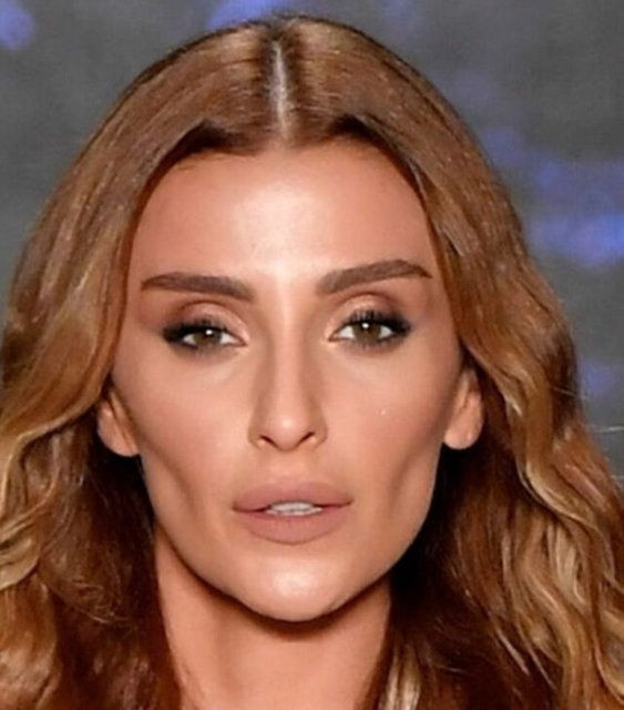 Özge Ulusoy 'ilk estetiğim' deyip paylaştı yine kimse inanmadı olay değişim - Resim: 2