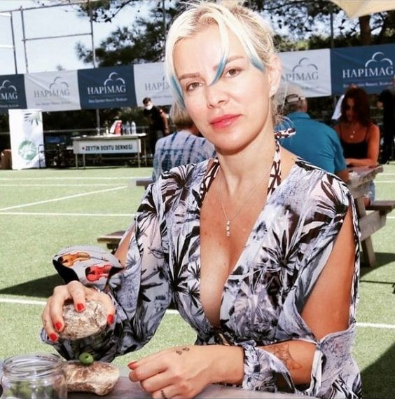 Vücudu kendi kendine zarar veriyor tedavisi olmayan hastalığını Ömür Gedik anlattı - Resim: 2