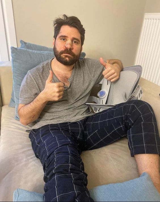 Ceyhun Fersoy kaza sonrası halini ilk kez paylaştı! Serkan Deveci 'ölmedim hayattayım' resmi attı - Resim: 3