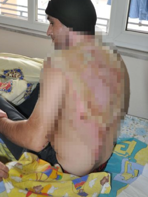 Cezaevinde korkunç işkence! - Resim: 4