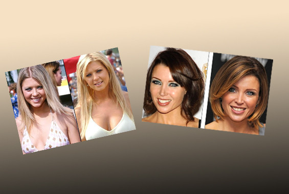 Estetikle güzelleşeyim derken... - Resim: 1