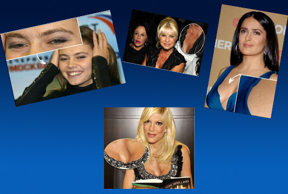 Ünlülerin yakından görüntüleri korkunç - Resim: 1