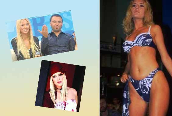 Estetik mucizesi ile baştan yaratılan ünlüler - Resim: 1