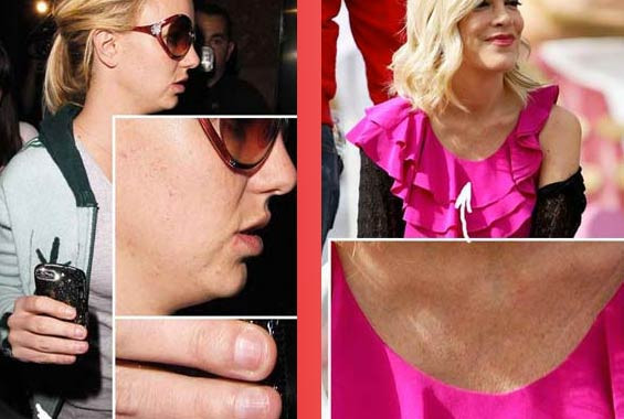 Ünlülerin yakından halleri korkunç - Resim: 1