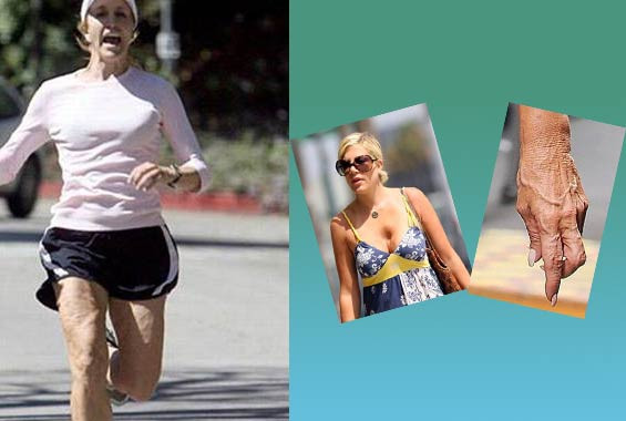 Ünlülerin defolu halleri - Resim: 1