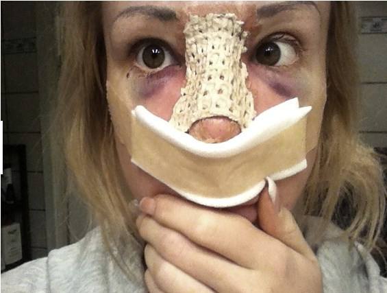 20 yaşına gelmeden 12 estetik yaptırdı! - Resim: 2