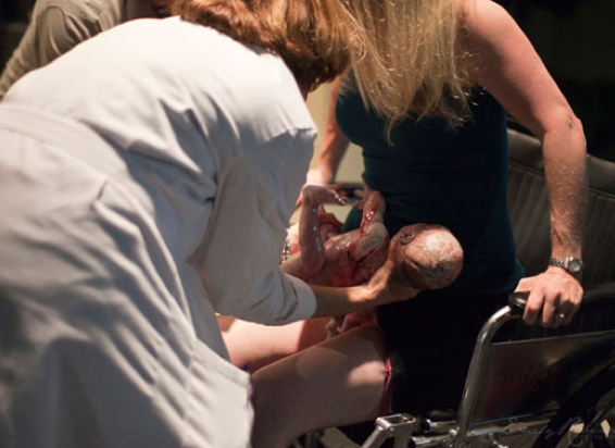 Mucize doğumu kare kare görüntüledi - Resim: 3