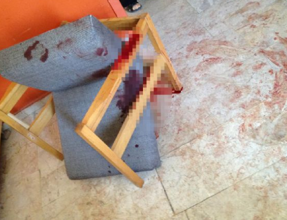 Öğretmene feci dayak - Resim: 1