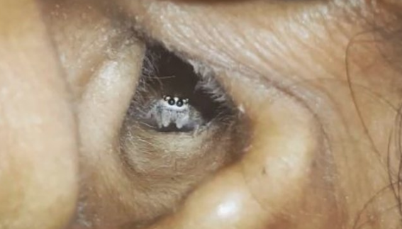 Baş ağrısı şikayetiyle gitti bakın kulağından ne çıktı? - Resim: 4