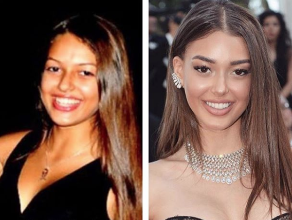 Henüz 23 yaşında ama Çukur'un Sena'sı Dilan Çiçek Deniz'in estetikleri yok artık dedirtti - Resim: 3