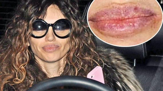 Ünlü oyuncunun bu hali görenleri şok etti - Resim: 1