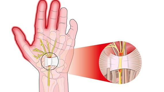Bu hastalık masa başındakileri seviyor - Resim: 1