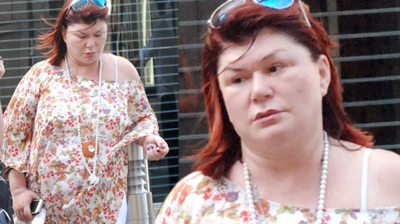 Aldığı kilolarla dehşete düşürdü - Resim: 1