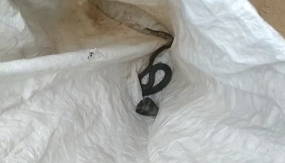 Kadını yılan soktu kocası iyileşsin diye inek pisliğine gömdü! - Resim: 2